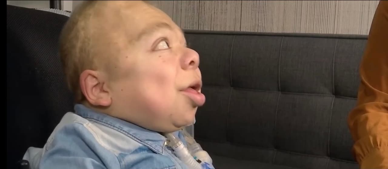 A pesar de este difícil contexto, Christopher se ha convertido en la prueba de que todos los sueños se cumplen siempre de la mano de la constancia, esfuerzo y amor. "Por más difícil que sea la situación, siempre hay una luz, siempre hay solución", afirma Álvarez.
<br>
<br>