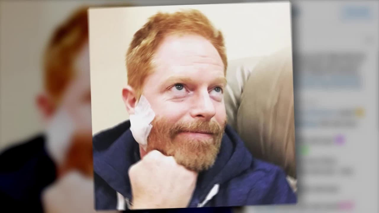 Actor de 'Modern Family' tuvo cáncer en el rostro