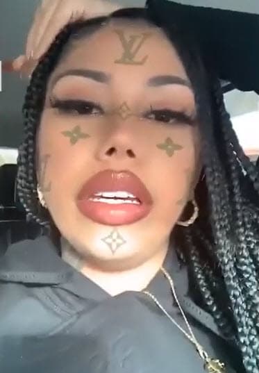 La expareja de Tekashi 6ix9ine se recupera en la elegante clínica Lluxe, ubicada en Cali, Colombia. Ahí permanecerá hasta mediados de mayo.