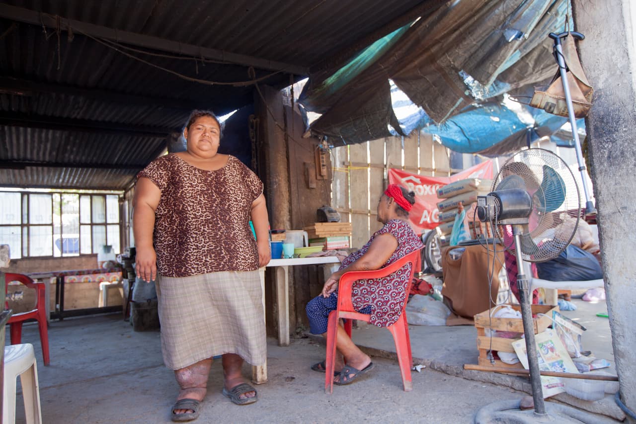 Grisel de los Santos, de 37 años, es la cabeza de su familia de ocho personas, entre los que se cuentan su madre, sus dos hijos y cuatro hermanos. Uno de sus hermanos sufre de diábetes y a raíz una infección que adquirió justo después del terremoto, tuvo que ser amputado de la pierna derecha. "Todo el dinero que nos dieron para reconstruir la casa lo gastamos en el doctor. Si no, la infección podía afectarle la columna a mi hermano, y así le daban solo tres meses de vida", cuenta de los Santos.