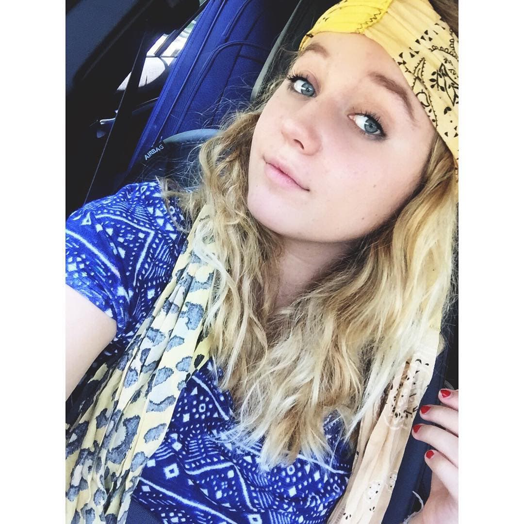 Así luce su nueva nariz, ¿qué opinas de su cambio?