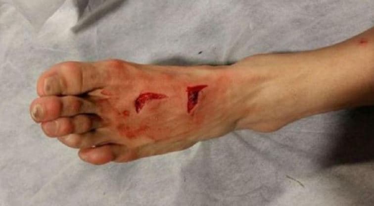 Héctor Herrera sufrió escalofriante herida ante la Juventus