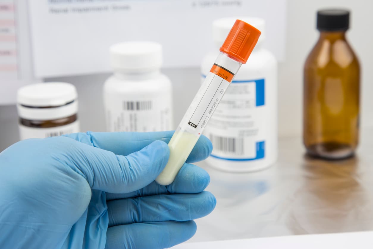 Tribunal ordena que deje de donar semen a un hombre que ha engendrado más de 500 hijos