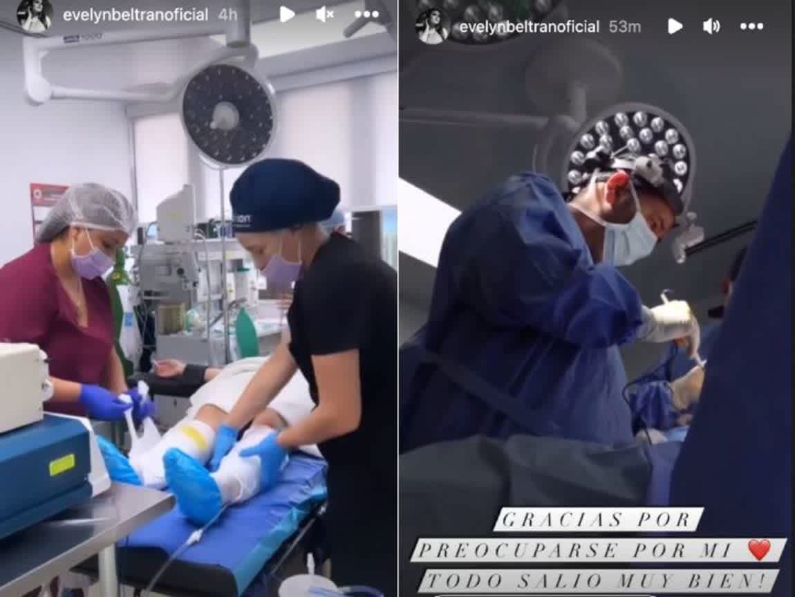 En mayo de 2020, la pareja de Toni Costa fue cuestionada en Instagram sobre los procedimientos estéticos a los que se ha sometido. 
<br>