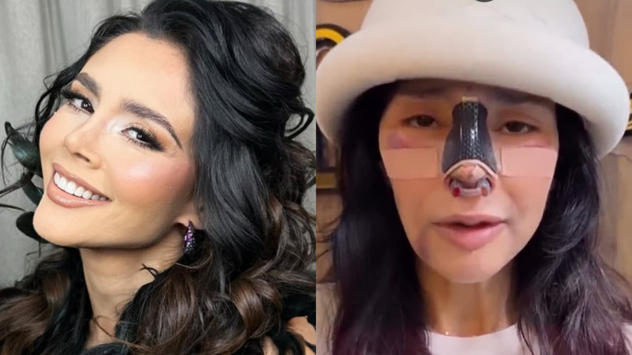 Excolaboradora de El Gordo y La Flaca revela cómo está luego de nueva cirugía tras quedar "desfigurada"