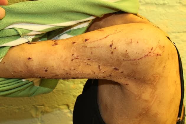 El 22 de abril de 2015 Zúnduri logró escapar de su encierro gracias a un descuido de la dueña de la tintorería. Así terminó con 5 años de trabajos forzados y puso de manifiesto el drama de los esclavos modernos.