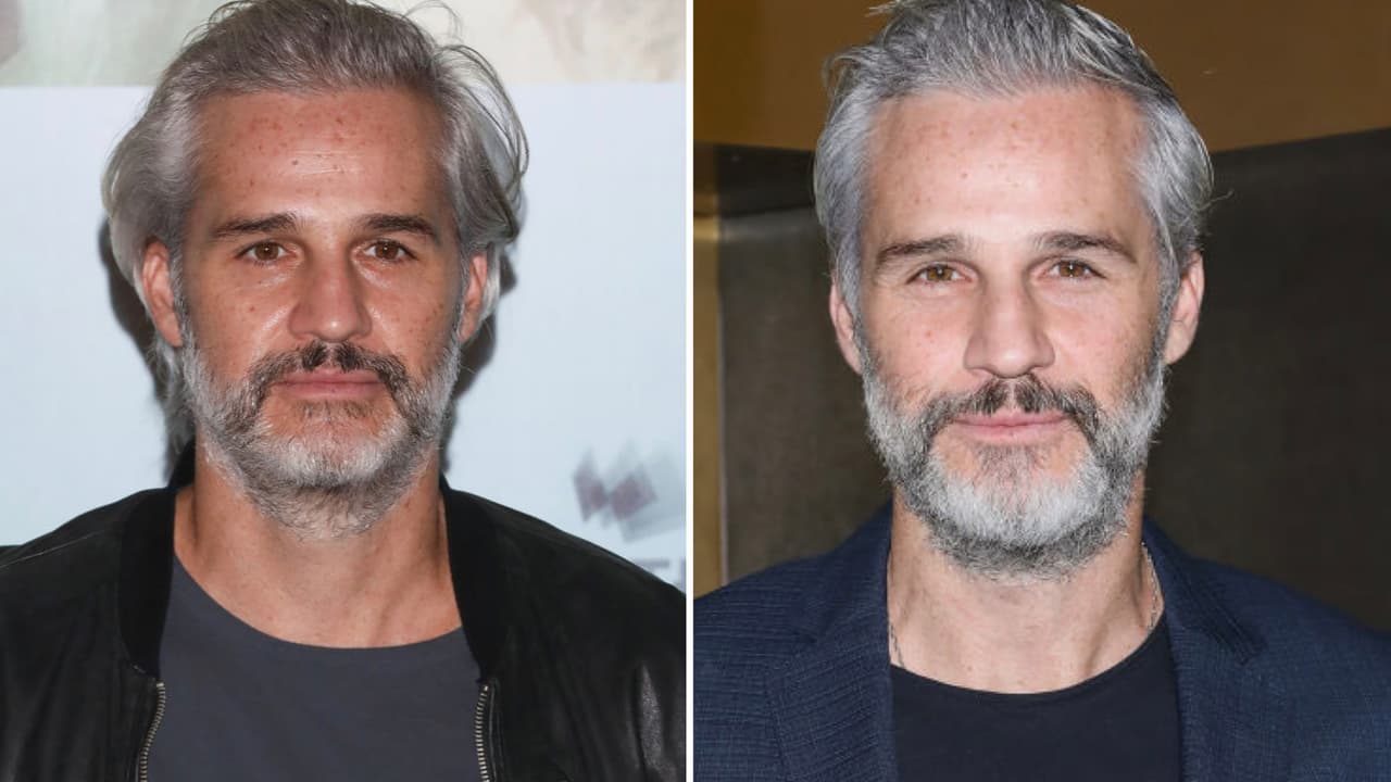 "Pensaban que era intoxicación": Juan Pablo Medina contó cómo los médicos decidieron amputarle la pierna