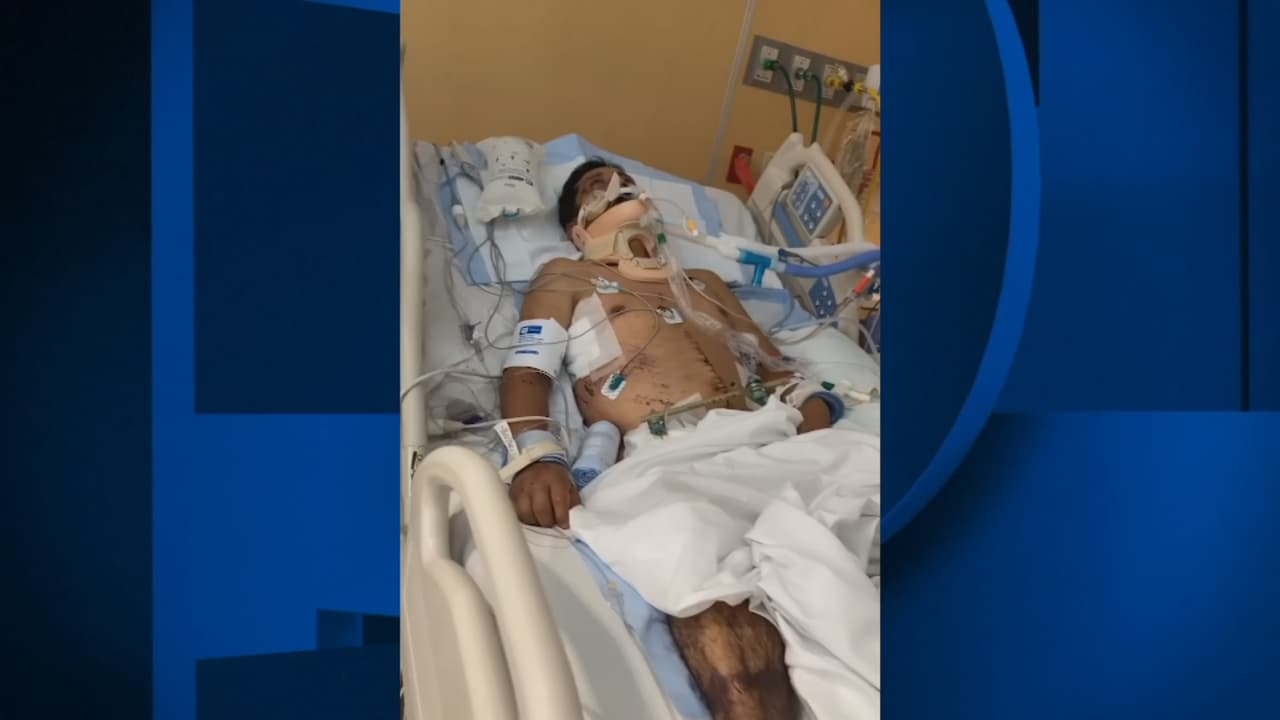 Sale de coma el inmigrante que sufrió graves heridas en choque de camioneta conducida por 'coyote'