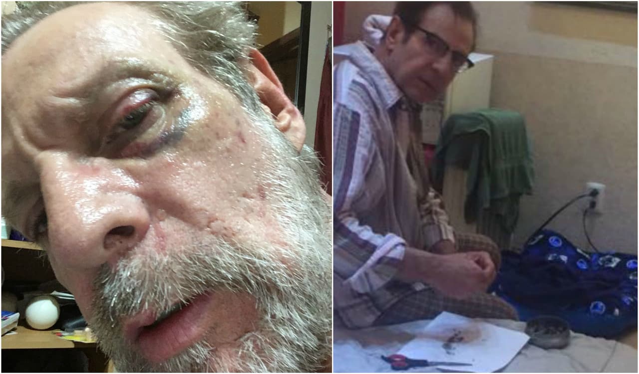 Para julio de 2017 se conoce una golpiza entre ambos, donde además de que Alejandro Tommasi casi pierde el ojo, su pareja lo acusó de consumir droga filtrando una foto donde se aprecia una hierba parecida a la marihuana.