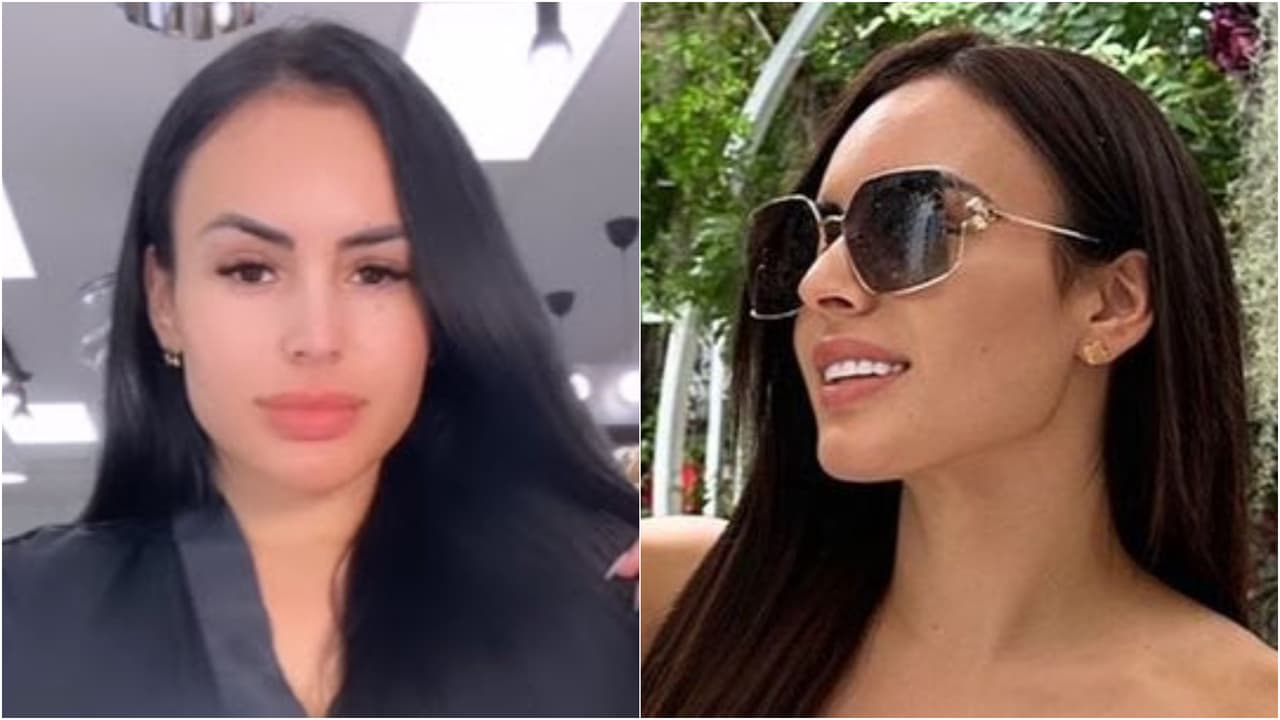 Evelyn Beltrán presumió su nueva sonrisa tras someterse al procedimiento.