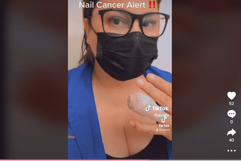 “¡Todo comenzó con una Mani/Pedi que terminó mal! ¡La manicurista me cortó con herramientas sin esterilizar lo que en 6 meses se convirtió en CÁNCER!”, dijo Grace García en una publicación de TikTok.