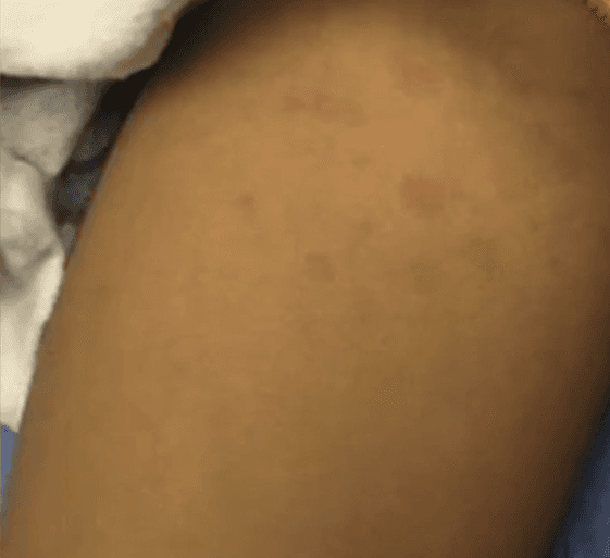 También pueden los niños presentar dificultad para respirar.