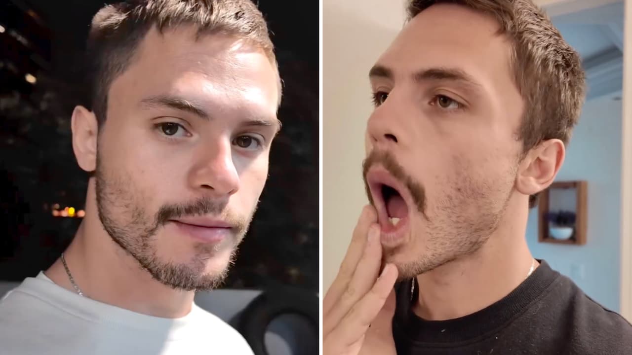 Hijo de Sergio Sendel se rompe el diente: el actor hace malabares para pegárselo