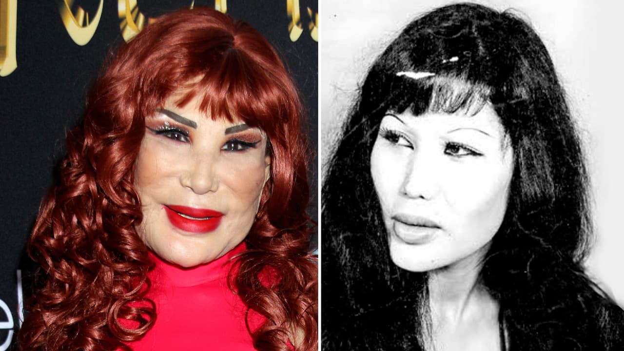 ¿Qué le pasó a Lyn May en el rostro? Así fue el día que le cambió la vida