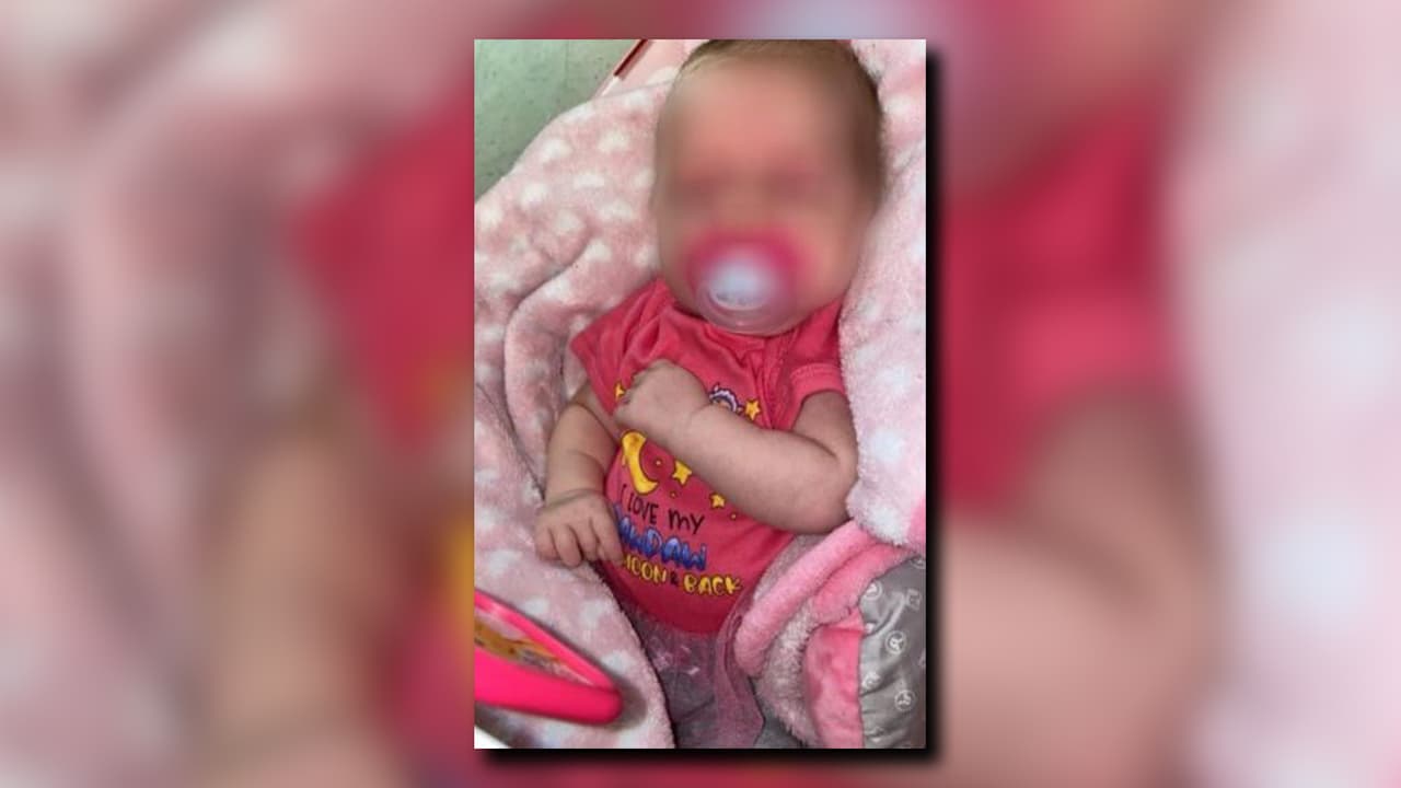 La bebé de dos meses presentó 27 huesos fracturados.