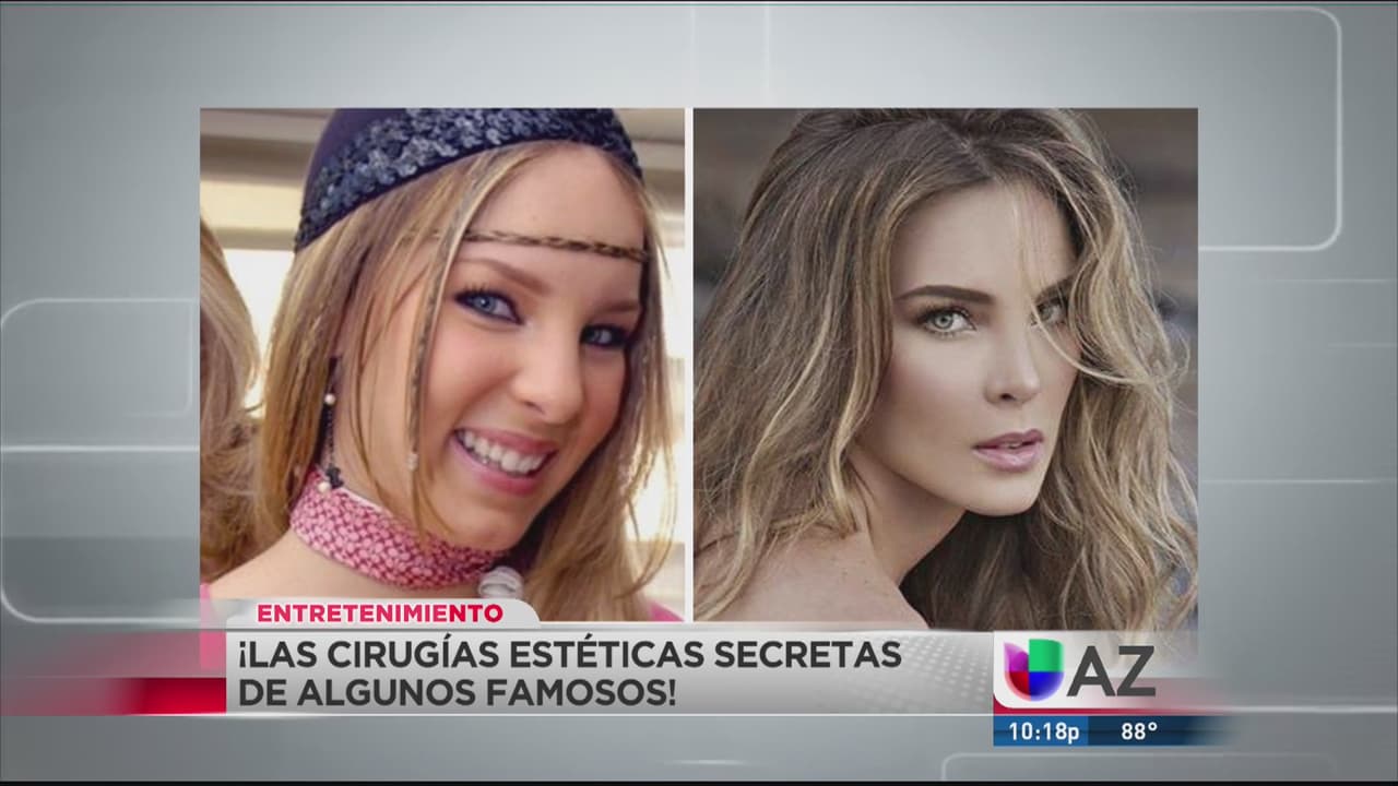 Al descubierto, las cirugías plásticas de las estrellas