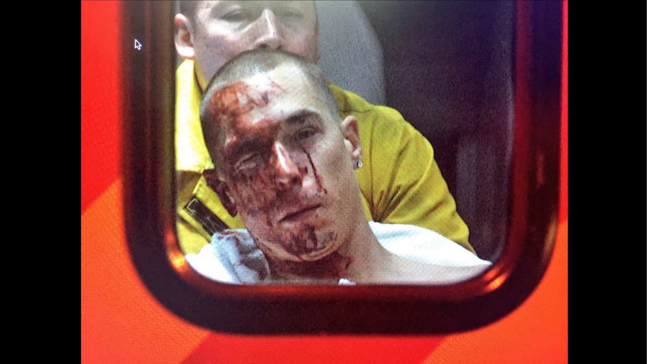 Automovilista recibe un balazo en el rostro mientras transitaba por la autopista 5