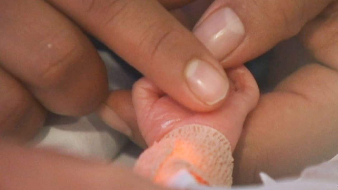 Se prenden las alarmas en México tras la muerte de 13 niños a causa de una bacteria