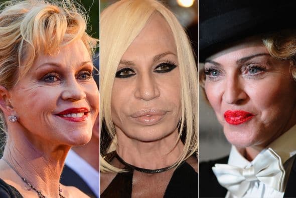 No conformes con su belleza natural y los estragos del paso de los años, estas estrellas han optado por ponerse botox por aquí y por allá.