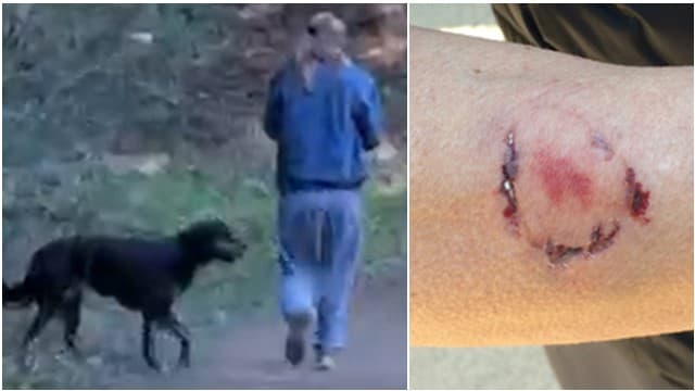 Arrestan a mujer que atacó a mordidas a corredora en Oakland