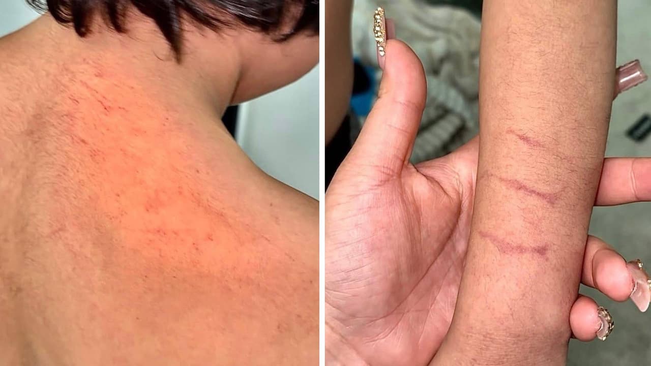 Madre acusa a terapeuta de agredir a su hijo con autismo en centro especializado en Avondale