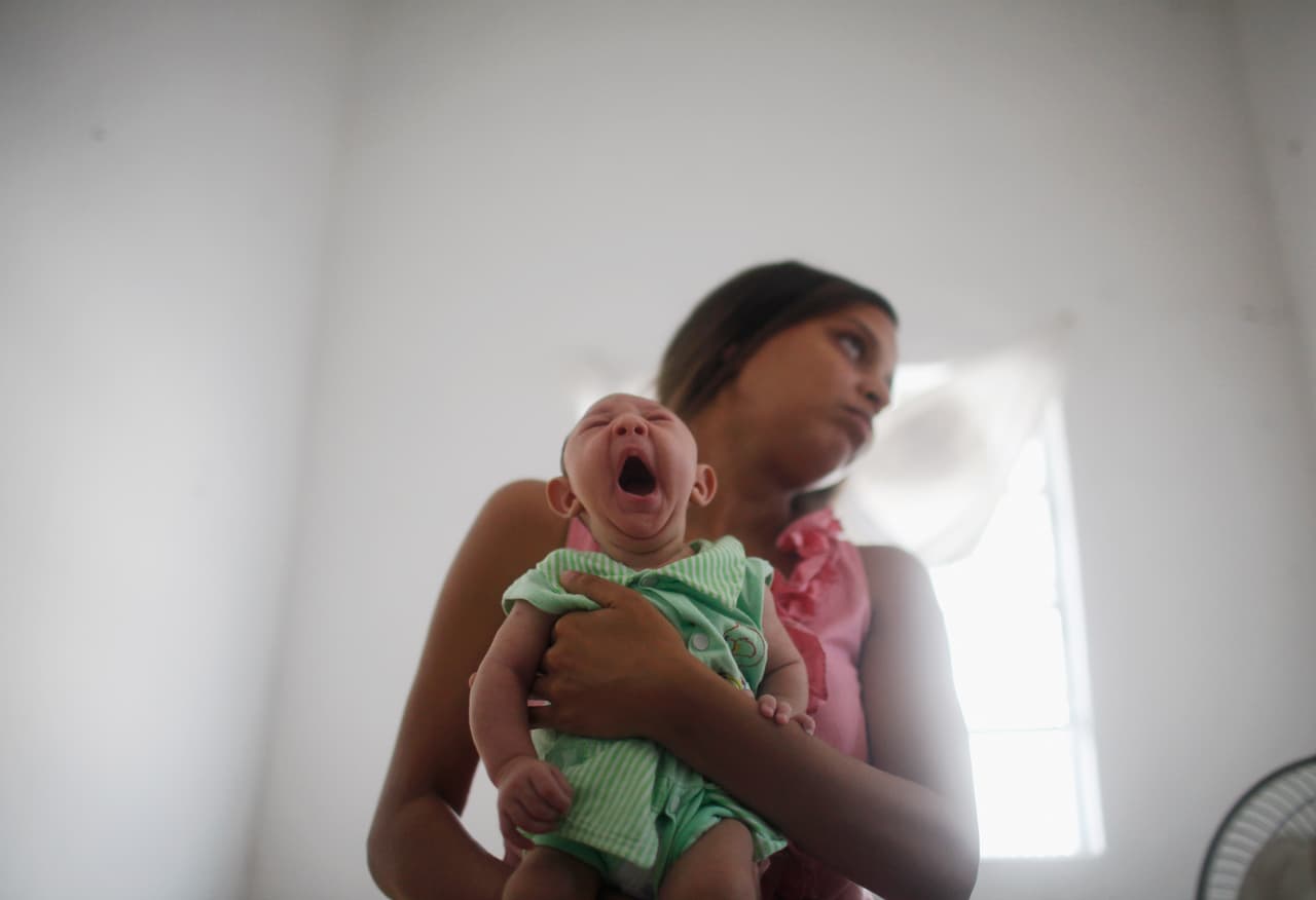 Aumentan casos de bebés con microcefalia en Brasil en medio de epidemia de zika