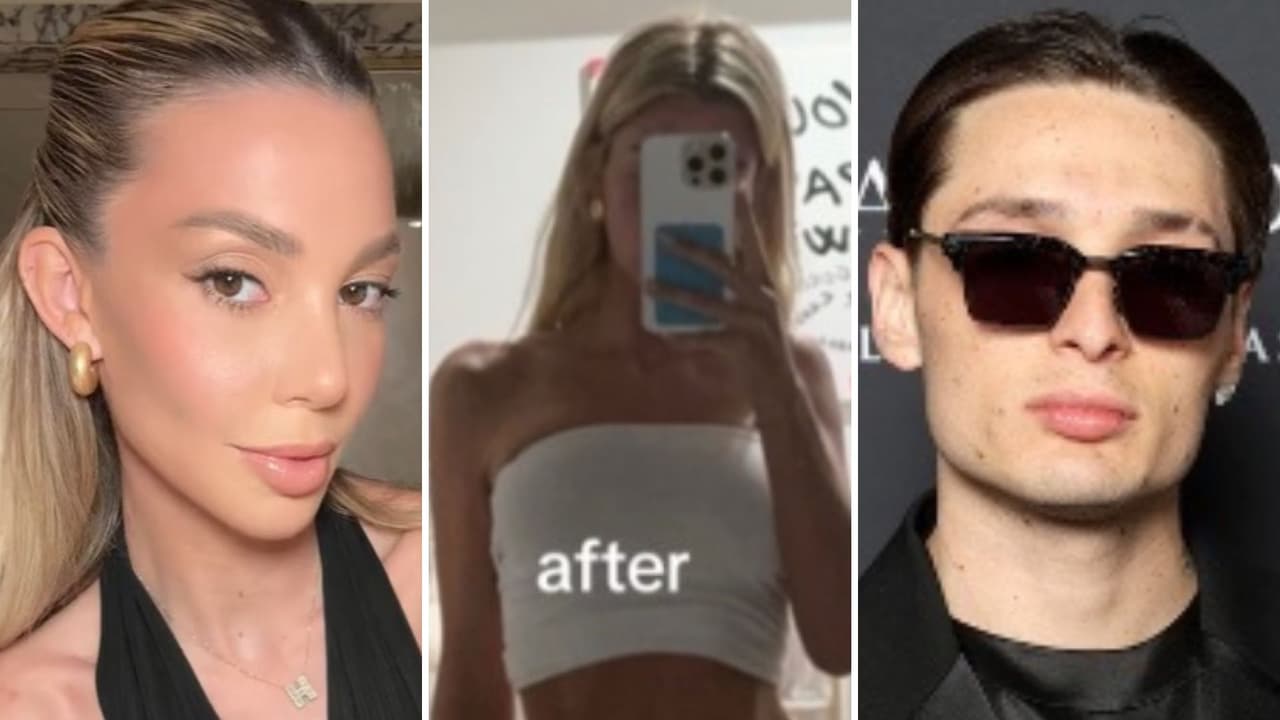 Ex de Peso Pluma muestra cambio físico y moretones en las rodillas tras ruptura con el cantante