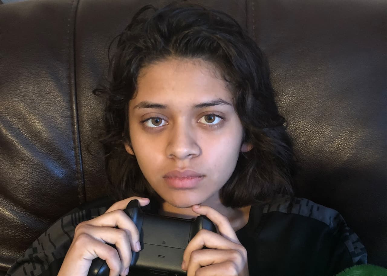 Cuatro diagnósticos tardíos emperoraron su condición. Los CDC advierten que el 50% de los casos de Fiebre del Valle son errónamente diagnosticados.