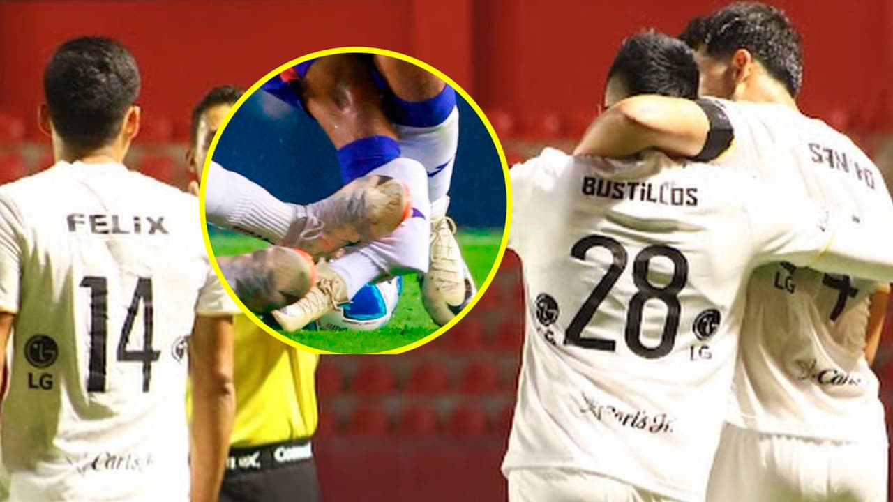 Inhabilitan tres meses al jugador que fracturó al Hobbit Bermúdez 