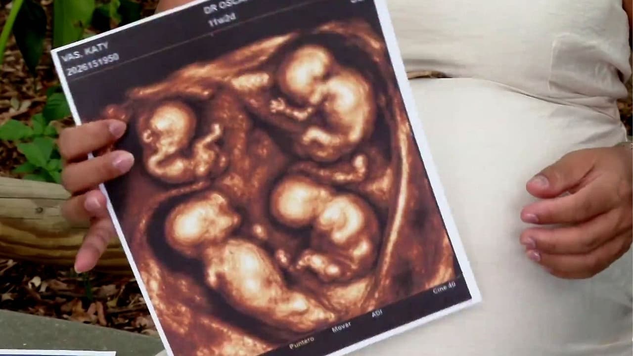 Nacimiento extraordinario en Colombia: Dan la bienvenida a cuatro bebés que podrían ser genéticamente idénticos