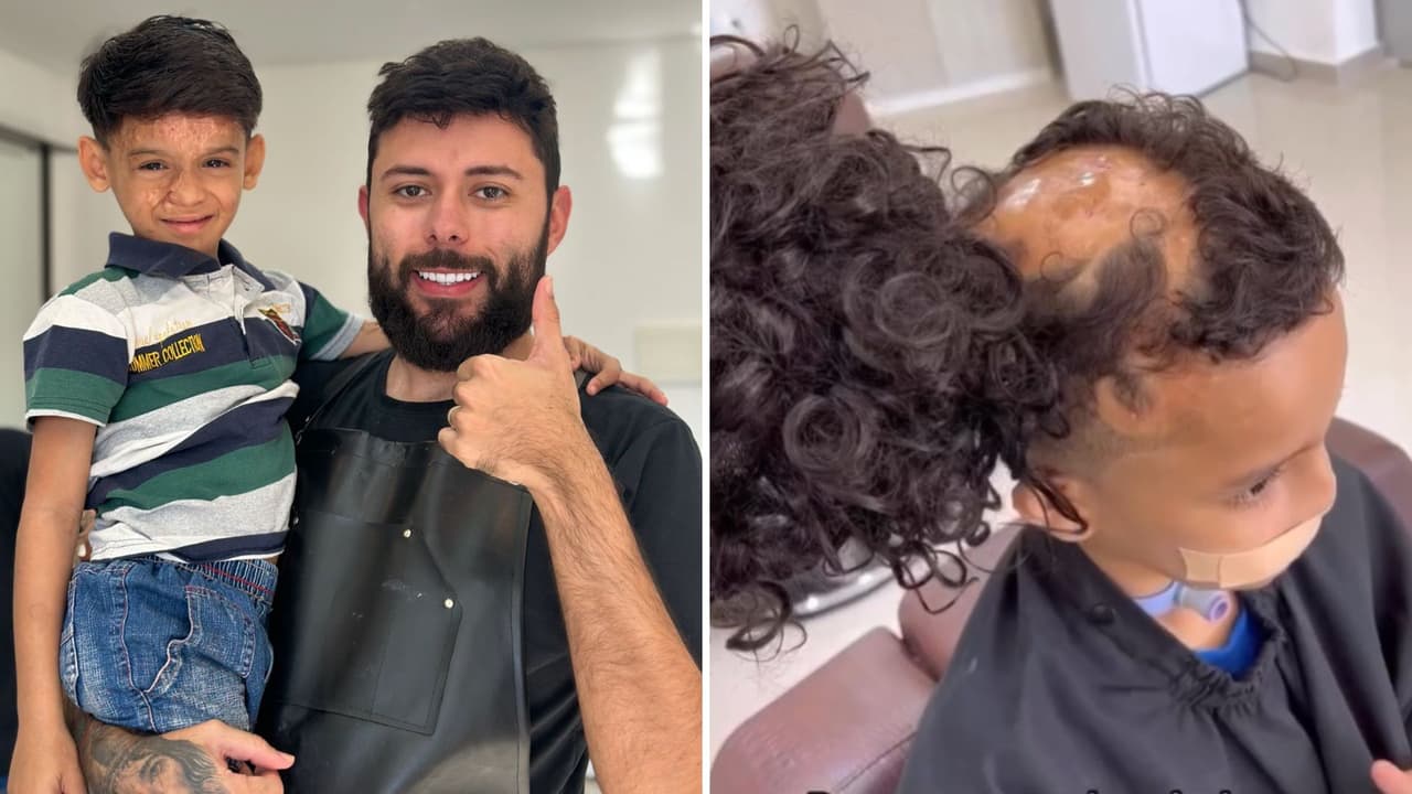 Peluquero devuelve la sonrisa a niños accidentados: les regala prótesis capilares