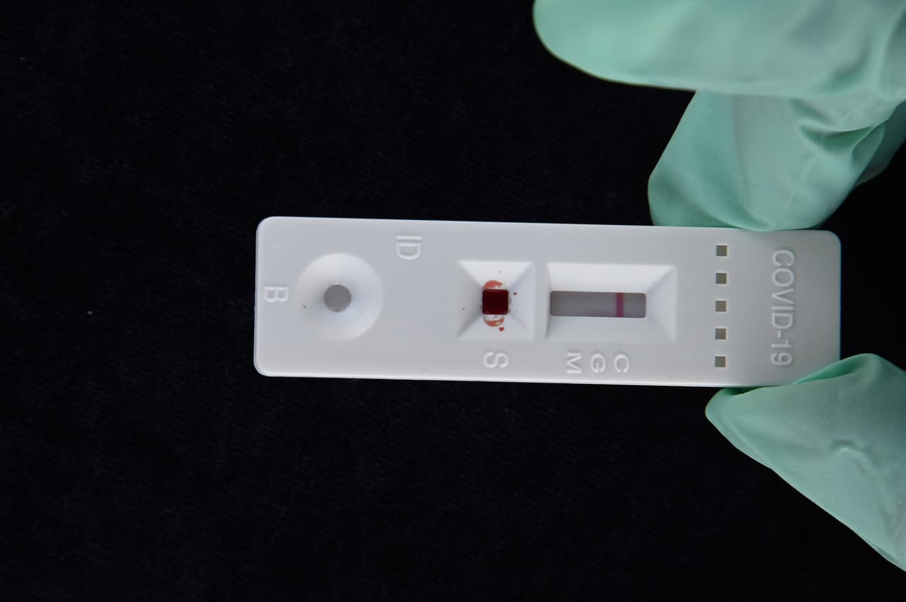 Sitios pop-up de pruebas de coronavirus: ¿Cómo reconocer si son legítimos? 