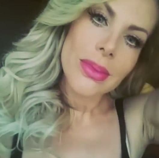 Mientras que al referirse al resto de su rostro, Lorena enfatizó: "Yo no tengo pómulos, tengo los mismos pómulos de antes".