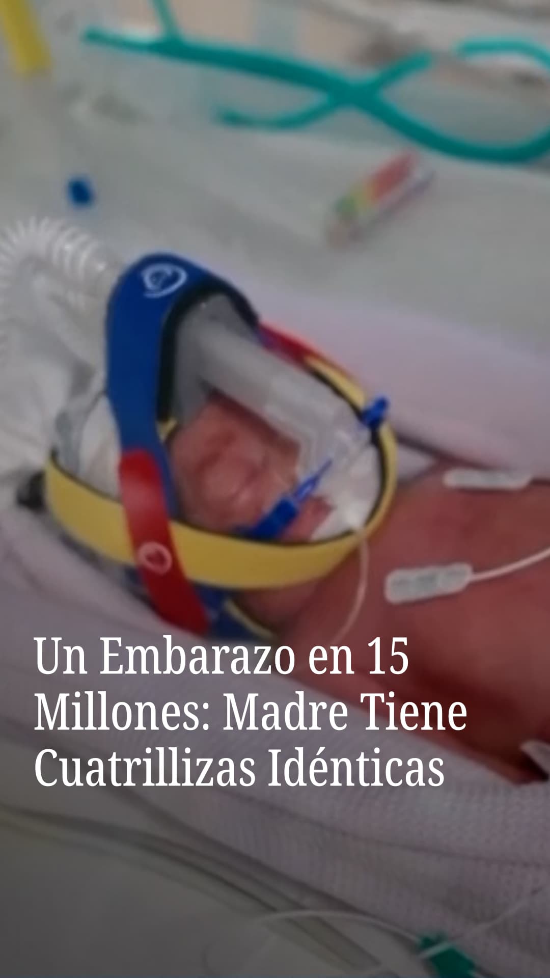 Un embarazo en 15 millones: Madre tiene cuatrillizas idénticas