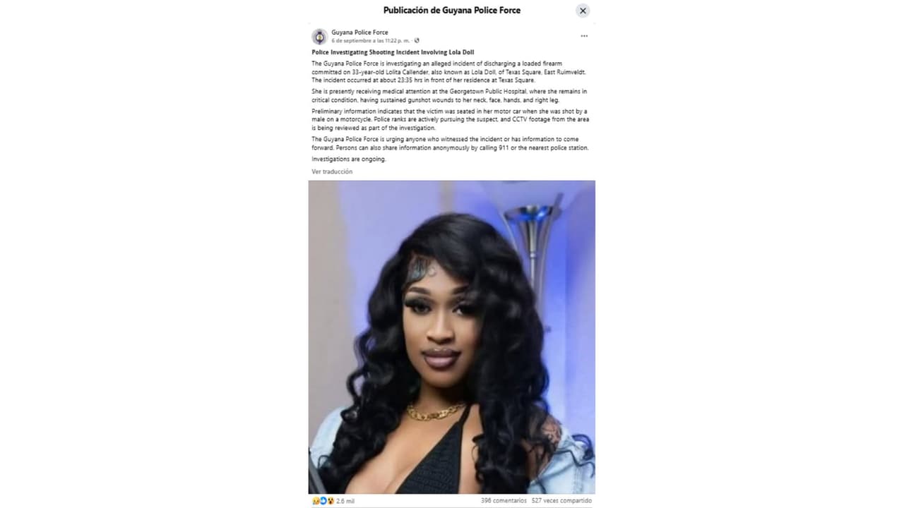 Reportan a Lola Doll en estado crítico.