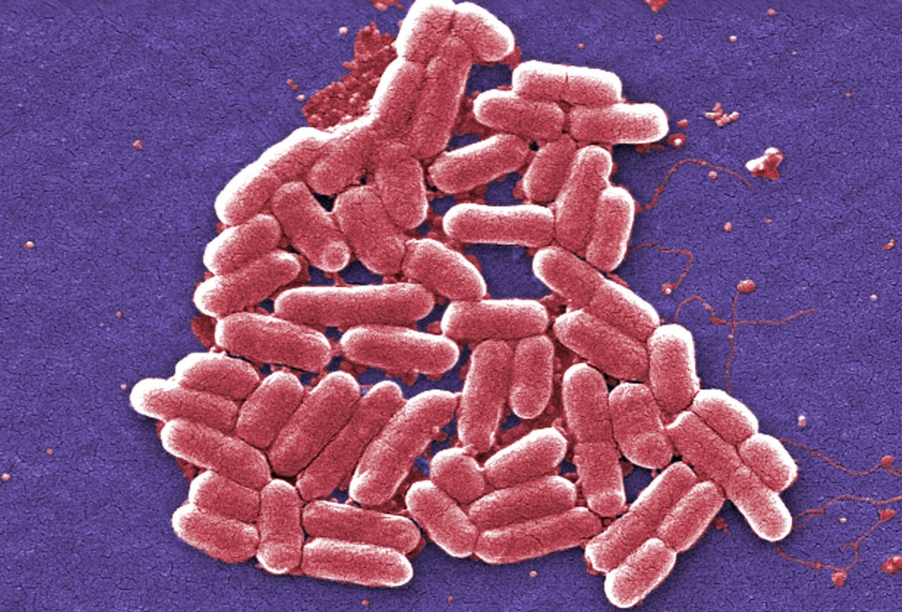 Esta micrafrafía coloreada de 2006 proporcionada por los Centros para el Control y la Prevención de Enfermedades (CDC, por sus siglas en inglés) muestra la cepa O157:H7 de la bacteria E. coli. El jueves 26 de mayo de 2016, autoridades militares de Estados Unidos reportaron el primer caso humano en Estados Unidos de una bacteria resistente a un antibiótico utilizado como último recurso. (Janice Carr/CDC vía AP)