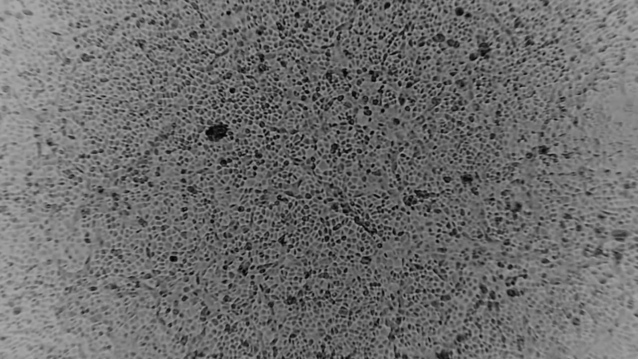  CDC: amplían las pruebas de detección de coronavirus para incluir el Aeropuerto Internacional de Filadelfia