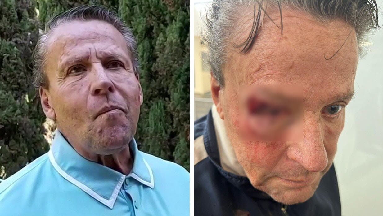 Alfredo Adame dice que podría tener "desprendimiento de retina" por golpiza afuera de su casa