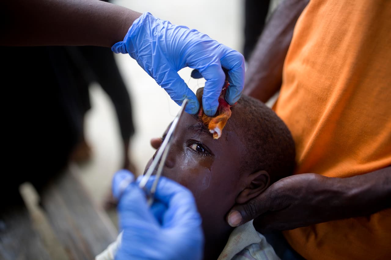 Un niño es atendido en un hospital de Port-de-Paix, en a costa noroeste de Haití y una de las zonas más afectadas por el terremoto de magnitud 5.9 del sábado que ya ha dejado 17 muertos y 333 heridos. El sismo tuvo réplicas que dejaron más heridos.