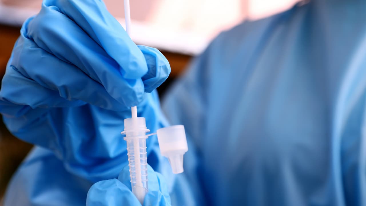 Según el doctor Joseph Varón, se calcula que esta es más contagiosa que delta, por lo cual hizo un llamado a la comunidad a inmunizarse. “No hay que bajar la guardia y se deben seguir acatando las medidas de seguridad para prevenir”, señaló.