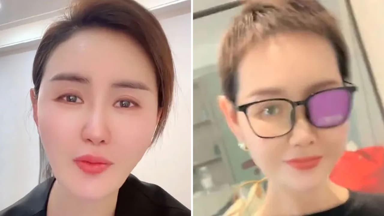 Muere ‘influencer’ tras luchar contra raro y agresivo tipo de cáncer: meses antes había perdido la vista