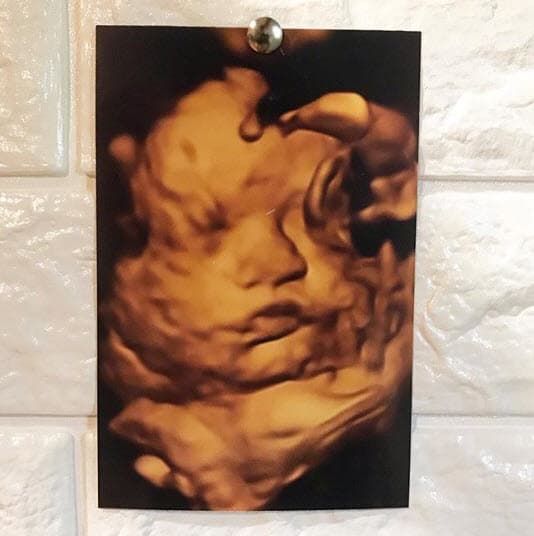 En ese momento El Dasa también sorprendió al revelar, en entrevista para Despierta América, que llevaba cinco años de relación con su novia, pues durante todo ese tiempo lo había mantenido en secreto.