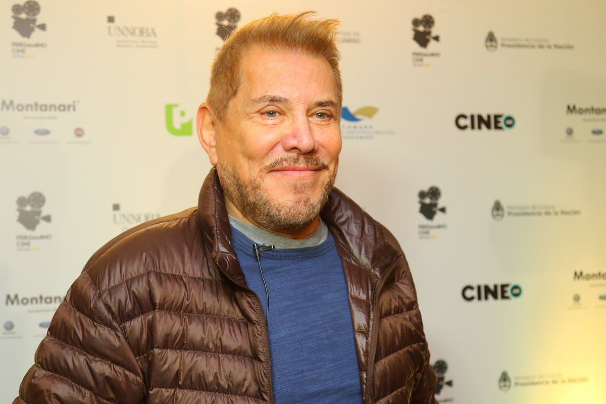 Este virus produce erupciones muy dolorosas en la piel pero, si se trata adecuadamente, no genera mayor problema.