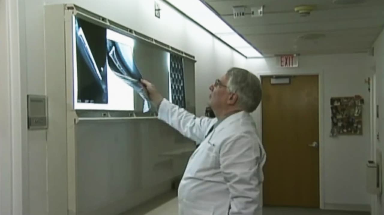 ¿Cómo podrían afectar al cuerpo los medicamentos para perder peso? Lanzan alerta por riesgos para salud ósea