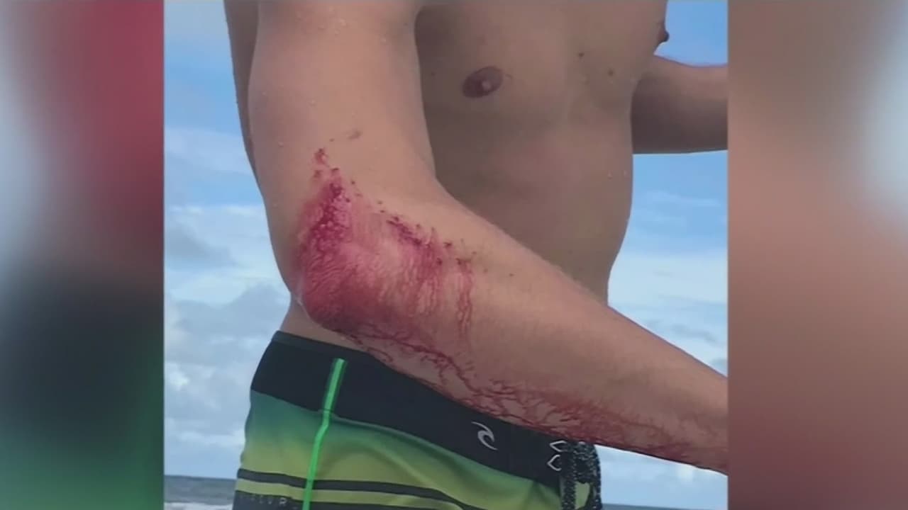 Ocurren dos ataques de tiburón en Florida con apenas una hora de diferencia