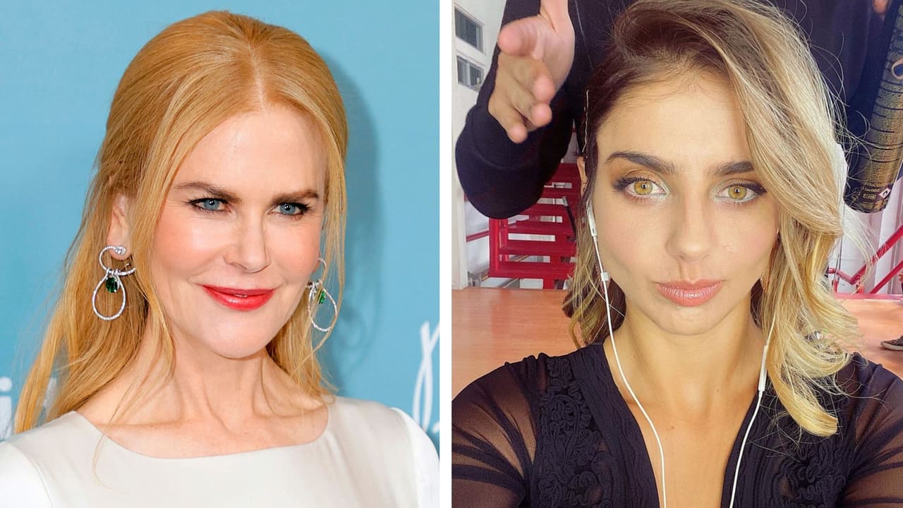  Famosas que se operaron por presión, pero se arrepintieron después