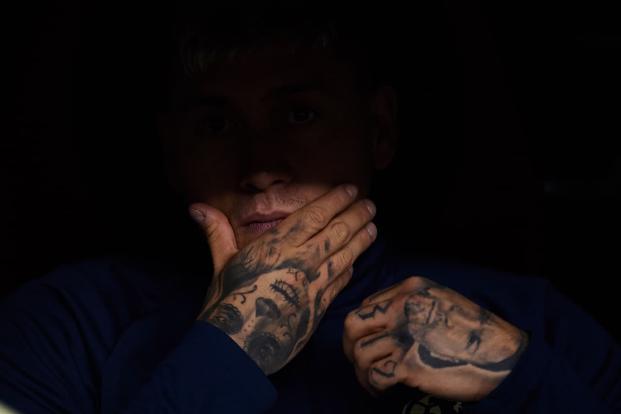 Una nueva lesión le impide brillar con el América; será baja para operarse y no tiene fecha de regreso.