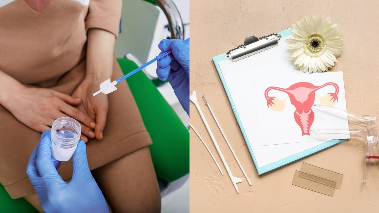 Cómo prepararse para el Papanicolau: esto debes hacer antes de tu prueba médica