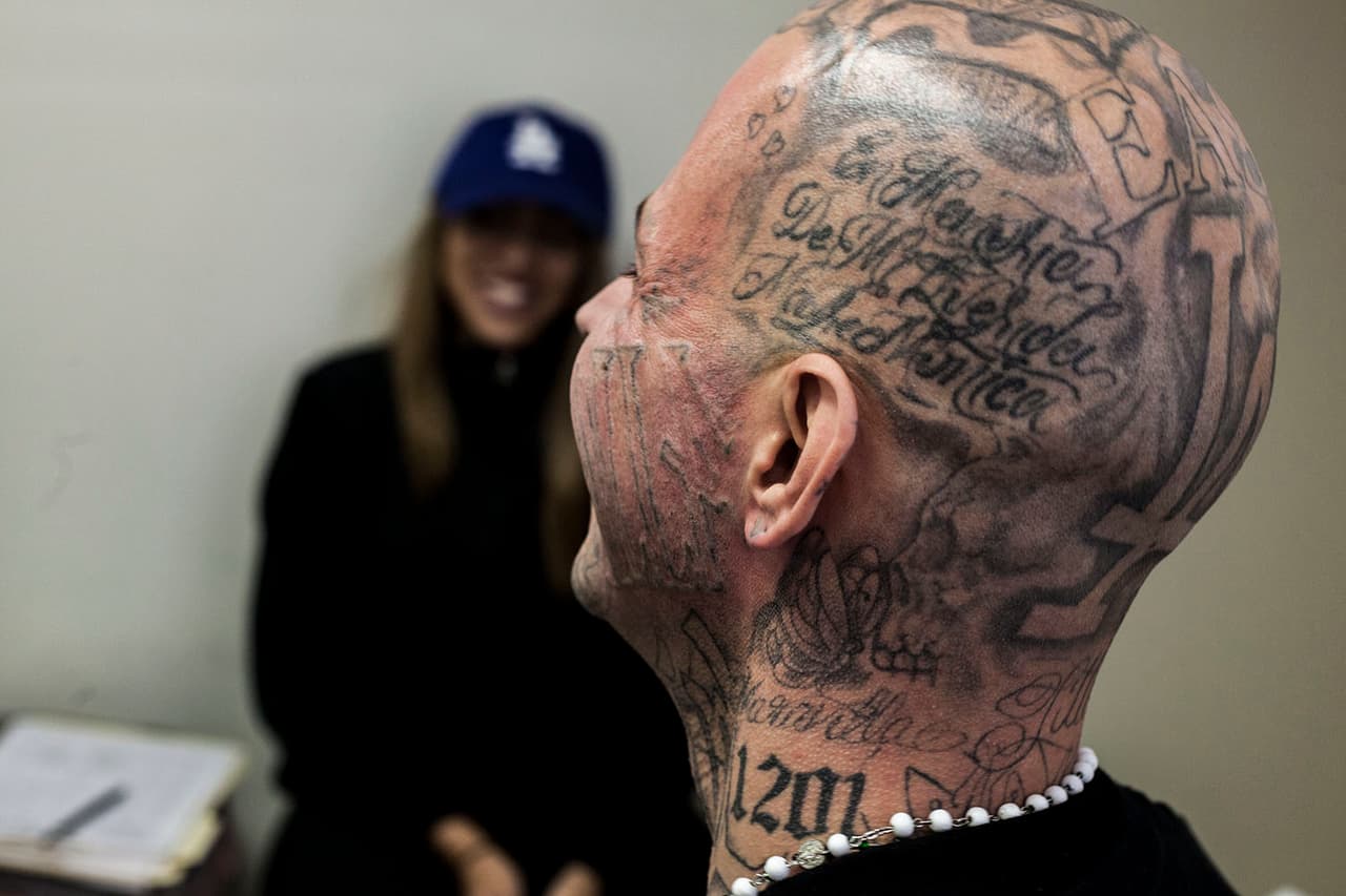 Con una máquina láser de más de 120,000 dólares se logra remover los tatuajes hasta que casi desaparecen completamente.