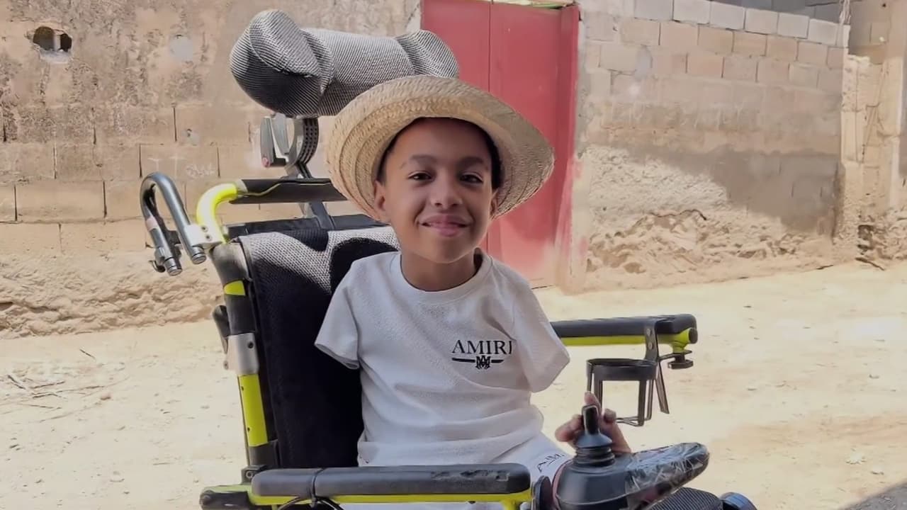 Niño sin extremidades conmueve en Venezuela por su talento para cantar